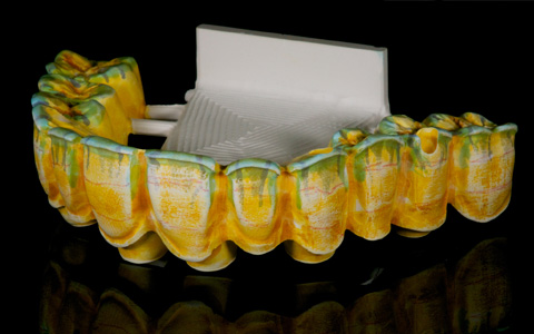 TEMP - Resina Dental Biocompatible para Coronas Temporales - Creativo 3D